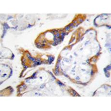 兔抗PHLDA2多克隆抗體