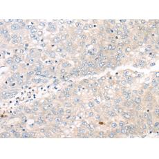 兔抗PNPO多克隆抗體