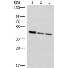 兔抗SCCPDH多克隆抗體    