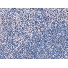 兔抗SCCPDH多克隆抗體    