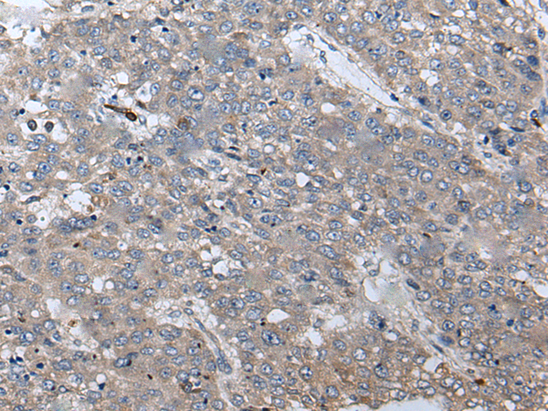 兔抗WIF1多克隆抗體  