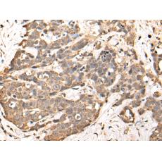 兔抗WDFY3多克隆抗體 
