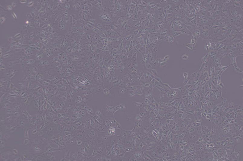 MDCK(NBL-2)犬腎細胞