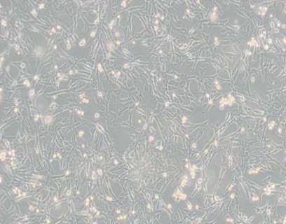 Super/Tube犬腎細胞